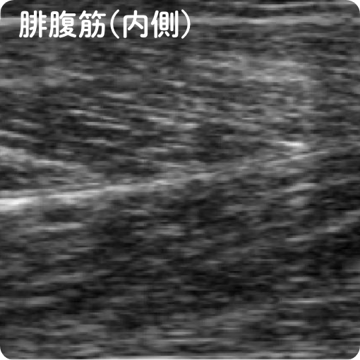 腓腹筋(内側)